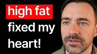 Clear Your Arteries In 30 Days! [100% Natural] Dr. Ovadia
