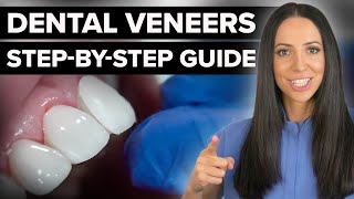 Dental Veneers Step By Step