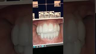 Implant Dentistry
