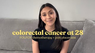 FOLFOX chemotherapy + port placement (colorectal cancer awareness)