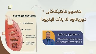 Dental suturing techniques