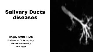 Salivary Ducts Diseases