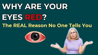 Why Your Eyes Are Red: Hidden Causes You Shouldn’t Ignore