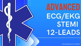 Mastering STEMI Recognition on 12-Lead EKG: Tips Every Paramedic Should Know