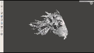 3D Model Lung Cancer Visualisation in Meshmixer - Applied Medical Visualization Group 4-2
