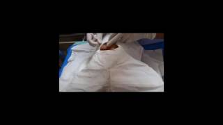 incision and curette for internal hordeolum by MDCU69 (fixed)