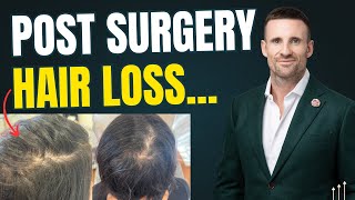 Hair Loss Q&A With A Hair Loss Doctor