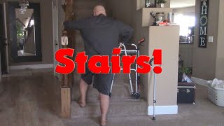 Stairs with Bilateral Total Knee Replacement with Mikey Mike 4 weeks PO