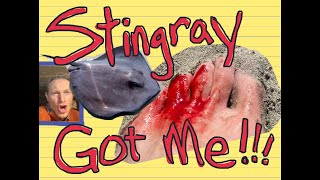 I stepped on a Stingray! What can you do to prevent or rebound from physical or even economic harm?