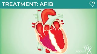 Treatment for Atrial Fibrillation (AFIB)