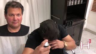 HairCube Thinning Hair Solution! (Amazing Before/After)