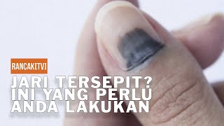 POV: Jari tersepit? Ini apa yang anda perlu tahu