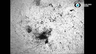 Kirana07 - Cavitation 1Million Frames Per Second - Specialised Imaging