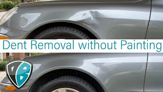 PDR Mercedes Fender Bender, Dent Removal without Painting | Dent Baron | Raleigh, NC