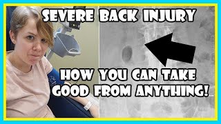 6 Powerful Life Lessons I Learned From Severe Back Injury