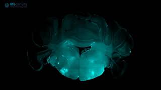 Whole mouse brain immunolabeled with anti-ChAT