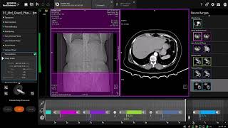 The four-phase liver CT protocol