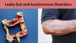 Understanding Leaky Gut and Its Connection to Autoimmune Disorders|  Holistic Healing Program (HHP)