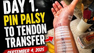 Day 1.  Pin palsy to tendon transfer  ￼September 4, 2025