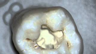 Labomed dental microscope magnification