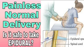 Painless normal delivery options in telugu | pain relief during labor in telugu | epidural