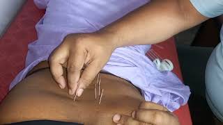 Skill Physio Academy Hooghly chinsurah west bengal india.Best Physio Academy govt of India