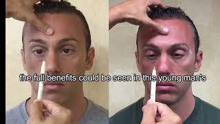 Improve VISION with These Simple Eye Exercises