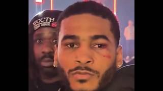 Tiger Johnson Gets Jumped by Team DHP  - My Thoughts