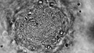 Movie S6: Characterization of epithelial cell shedding from engineered villi (brightfield imaging)