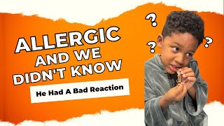 He Was Allergic And We Didin’t Know!!! @MeetTheMitchells 