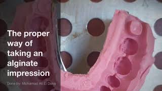 Alginate impression - Mohamad ali el dana 202000160