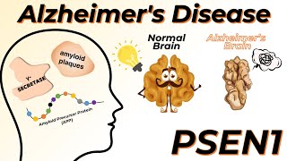 The real story behind Alzheimer’s Disease and PSEN1