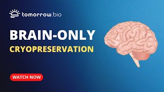 Tomorrow Bio Offering Brain-Only Cryopreservation
