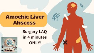 Amoebic Liver Abscess in 4 minutes ONLY (Surgery LAQ)
