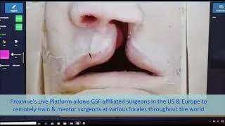 Global Smile Foundation selects Proximie to provide quicker access for cleft surgery in Ecuador