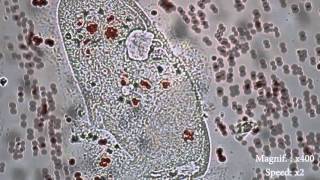 Paramecium Osmose