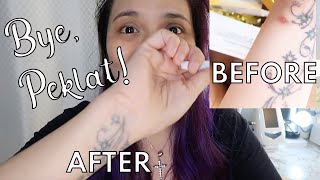 How I got rid of my scar ❤️(Paano mawala ang peklat?  Contractubex Review)
