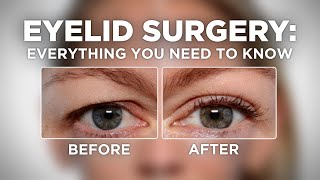 Before AND After WIDE AWAKE Upper Eyelid Blepharoplasty Surgery