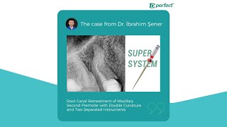 SuperSystem 2025 Winning Case: Retreat Conquers Double Curvature, 2 Tools