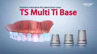 TS Multi Ti Base- Ti Base for digital denture solution