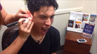 Ear Impressions