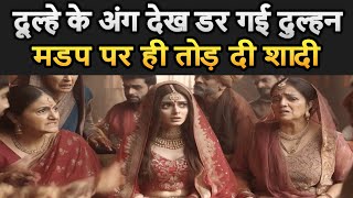 शादी पर कपडे बदल रहे दूल्हे के अंग देख कर डर गई दुल्हन - तुरंत तोड़ दी शादी