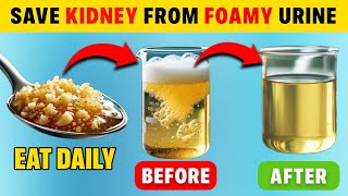 Top 10 Superfoods to Stop Proteinuria Quickly and Heal Kidneys Fast