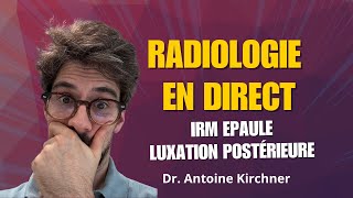 On dicte ensemble - Radiologie en direct - IRM chute de vélo - Radiologue Antoine Kirchner