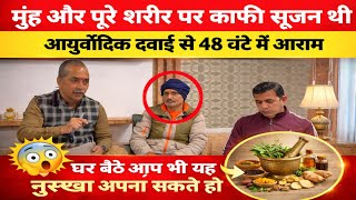 कैसे 48 घंटे में शरीर से सूजन कम हुई | आप यह तरीका कैसे अपना सकते हो | Dr Deepak Sharma 