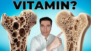 The #1 Vitamin to STOP Osteoporosis After 50