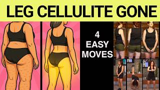 Cellulite Dimples, Ripples & Shadows On the Legs Are GONE In 4 Easy & Safe Leg Cellulite Exercises