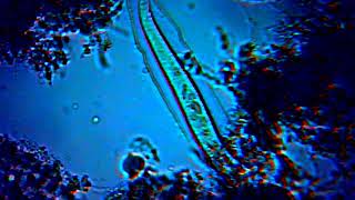Microorganisms in a drop of water under the MICROSCOPE - Microorganismos agua 1