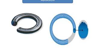 failure of o ring in hydrolic system