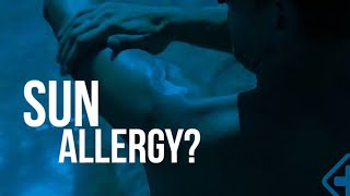 Sun Allergy? Here’s what you need to know!